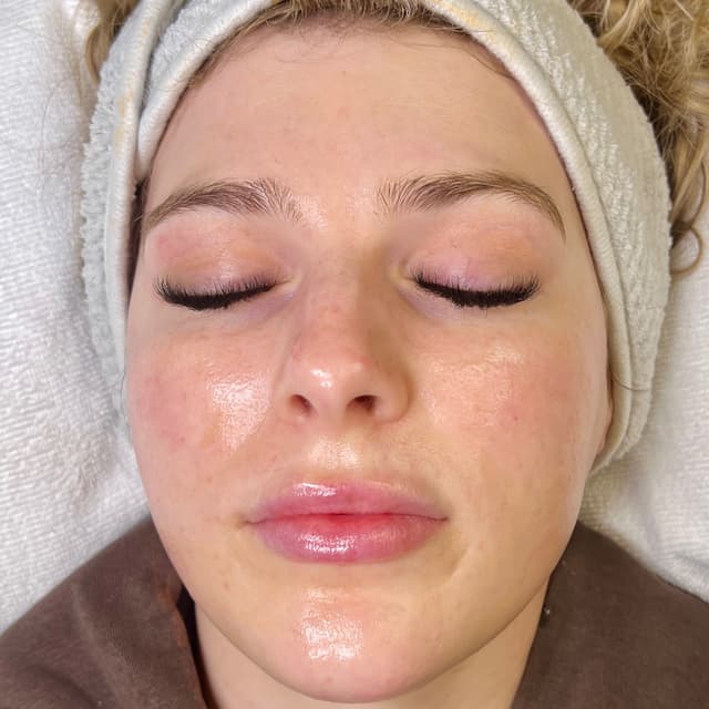 Dermaplaning 3 month package at Red’s Rose Beauty in Fresno, CA
