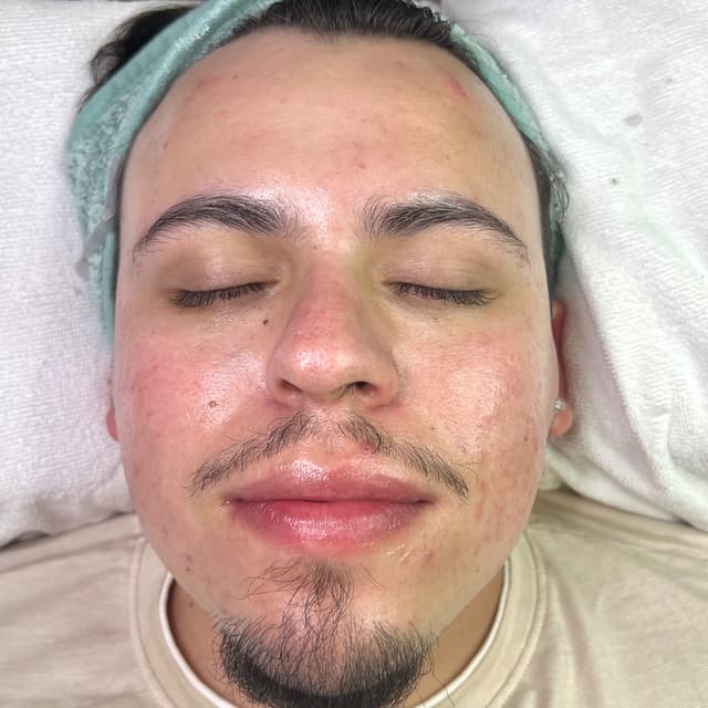 Men’s Dermaplaning 3 month package at Red’s Rose Beauty in Fresno, CA